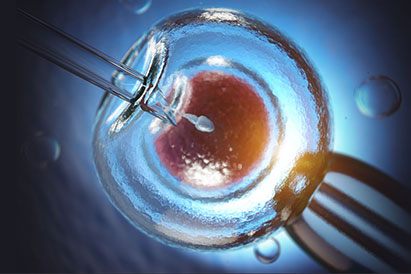 Timelapse System , Ashoka ivf in raipur