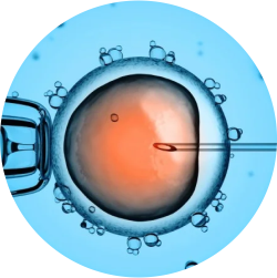 Advanced In-Vitro Fertilization