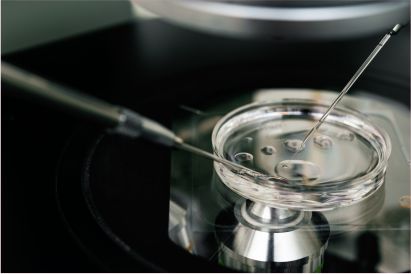 ashokaivf-advance-ivm-treatment