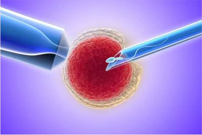 ashokaivf-advance-cytoplasmic-transfer-treatment